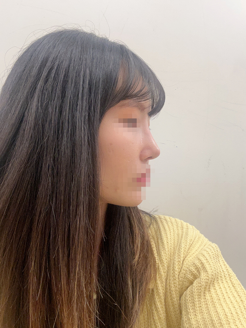 수술후기이미지