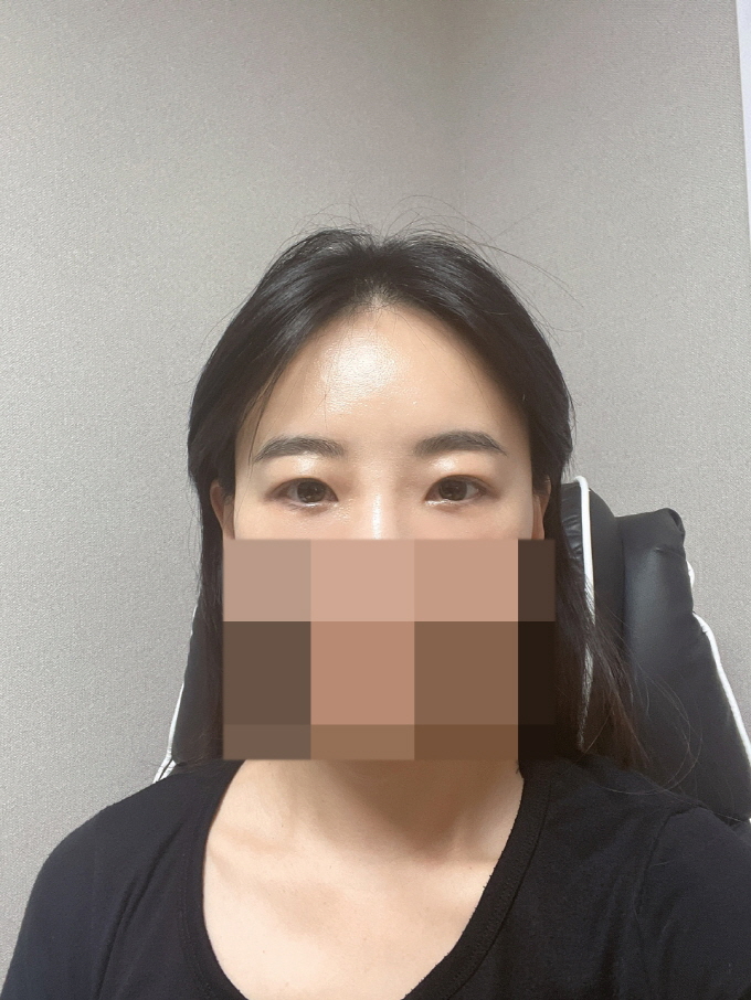 수술후기이미지