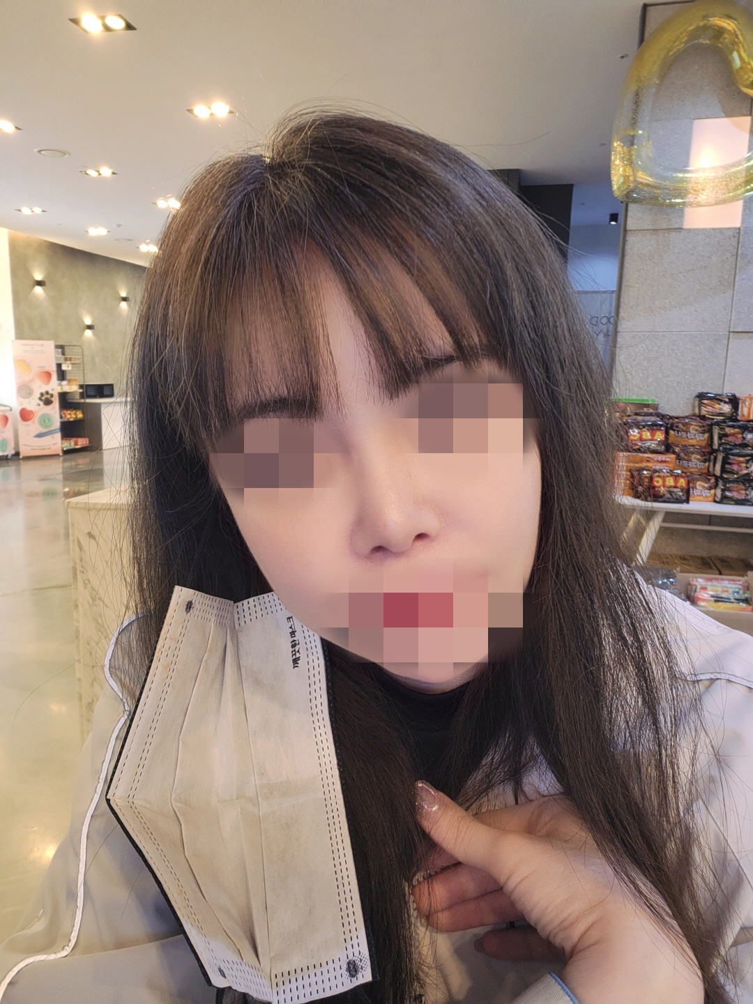 수술후기이미지