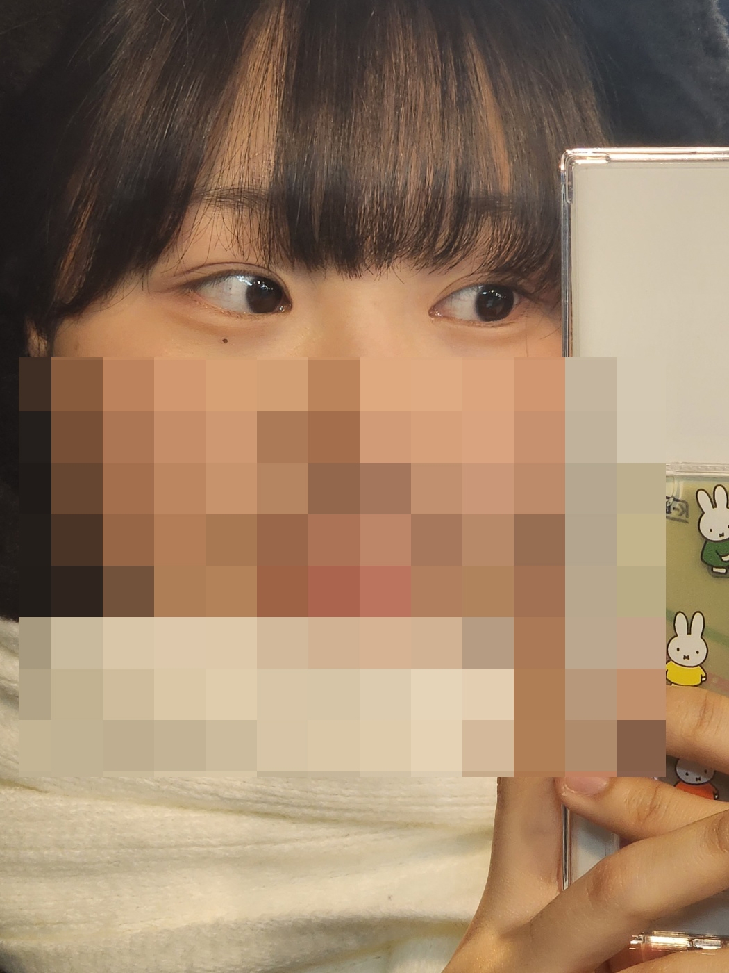 수술후기이미지