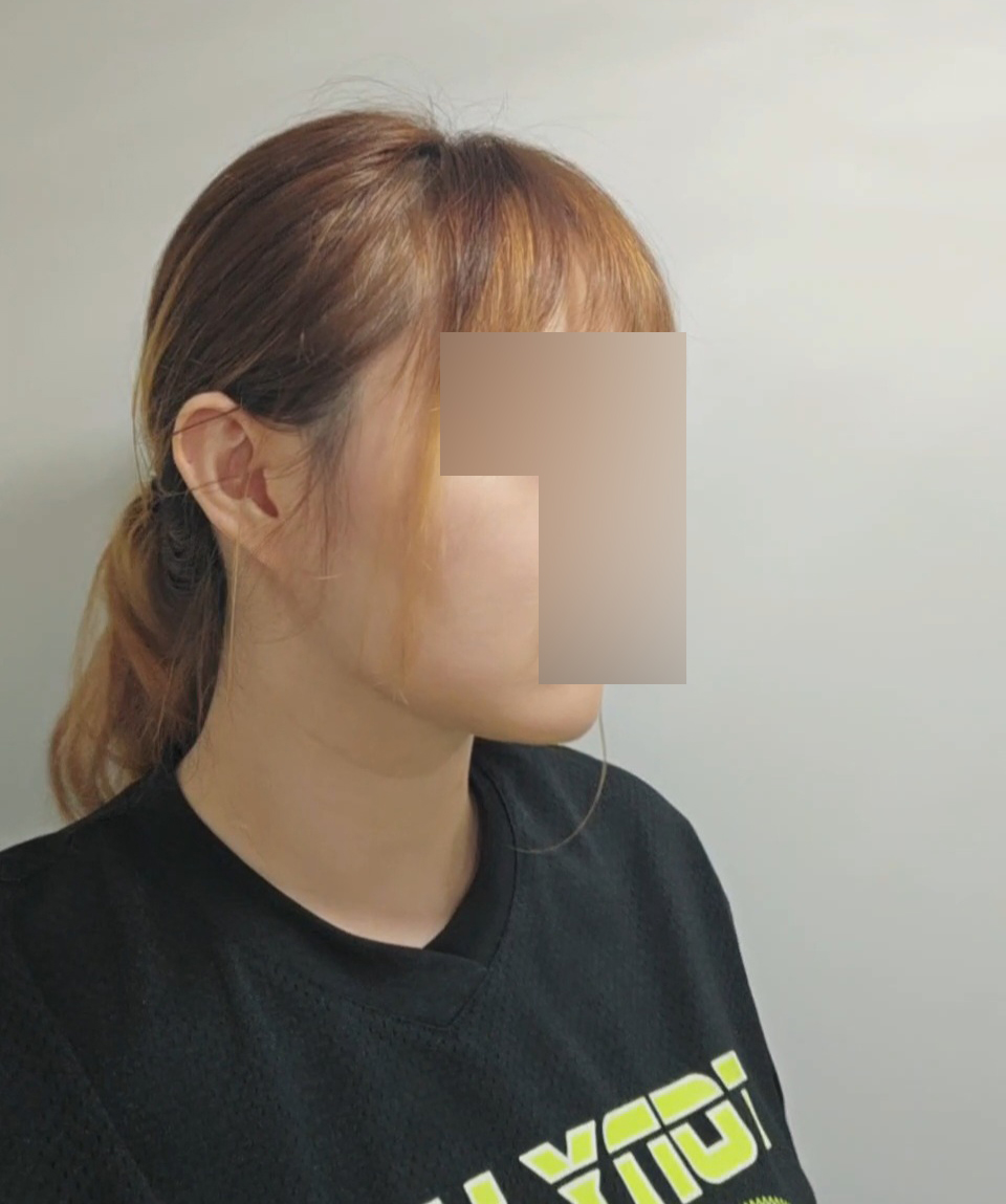 수술후기이미지
