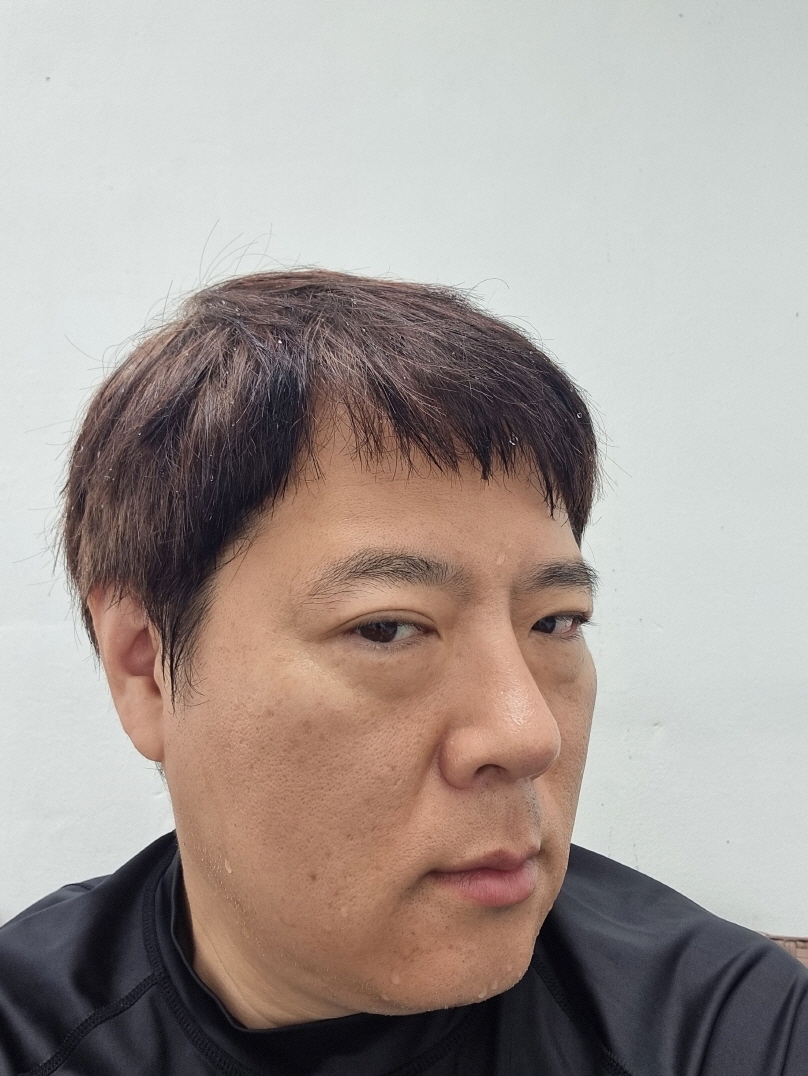 수술후기이미지