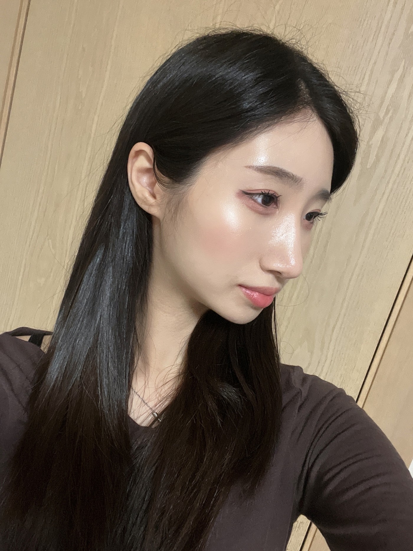 수술후기이미지