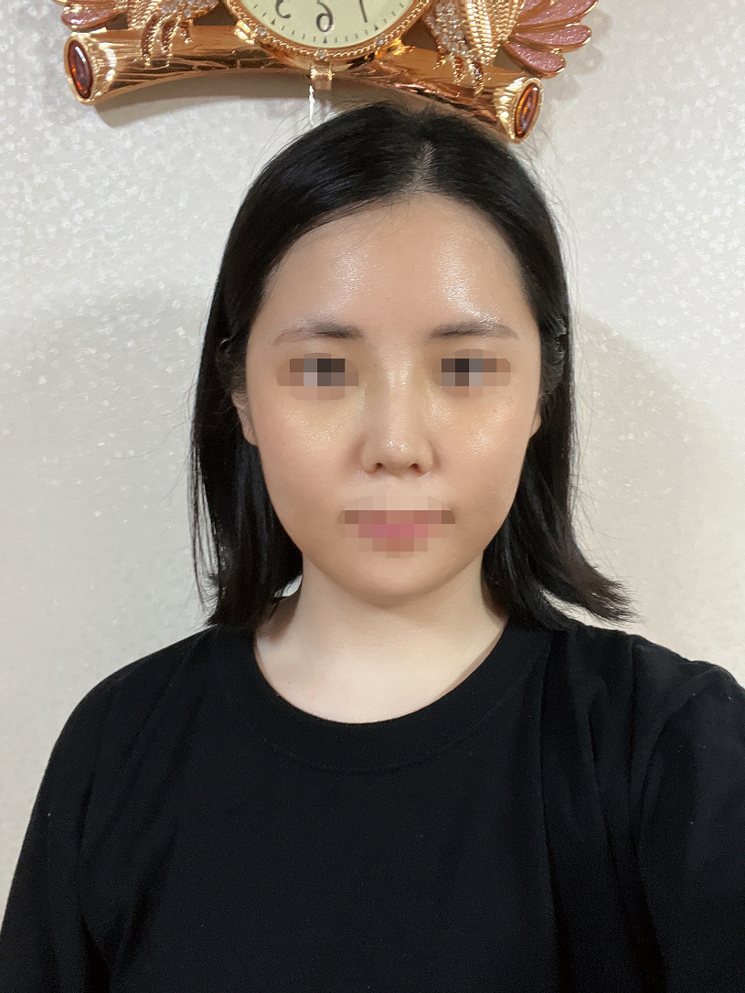 수술후기이미지