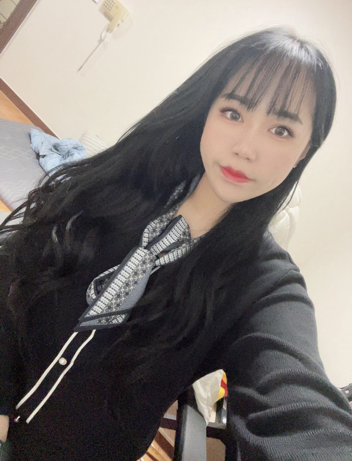 수술후기이미지