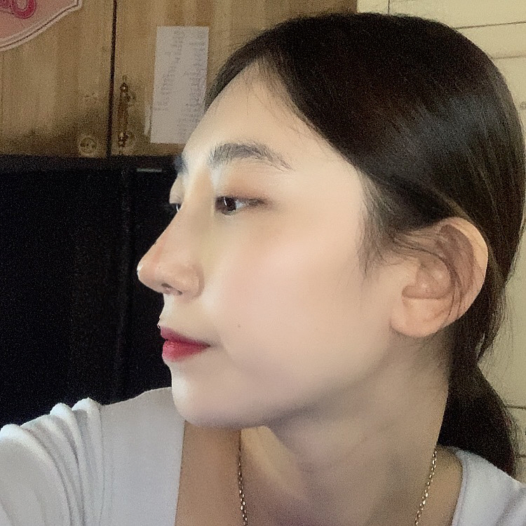 수술후기이미지