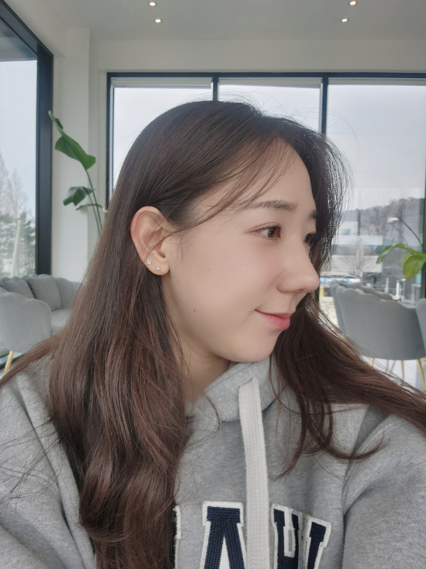 수술후기이미지