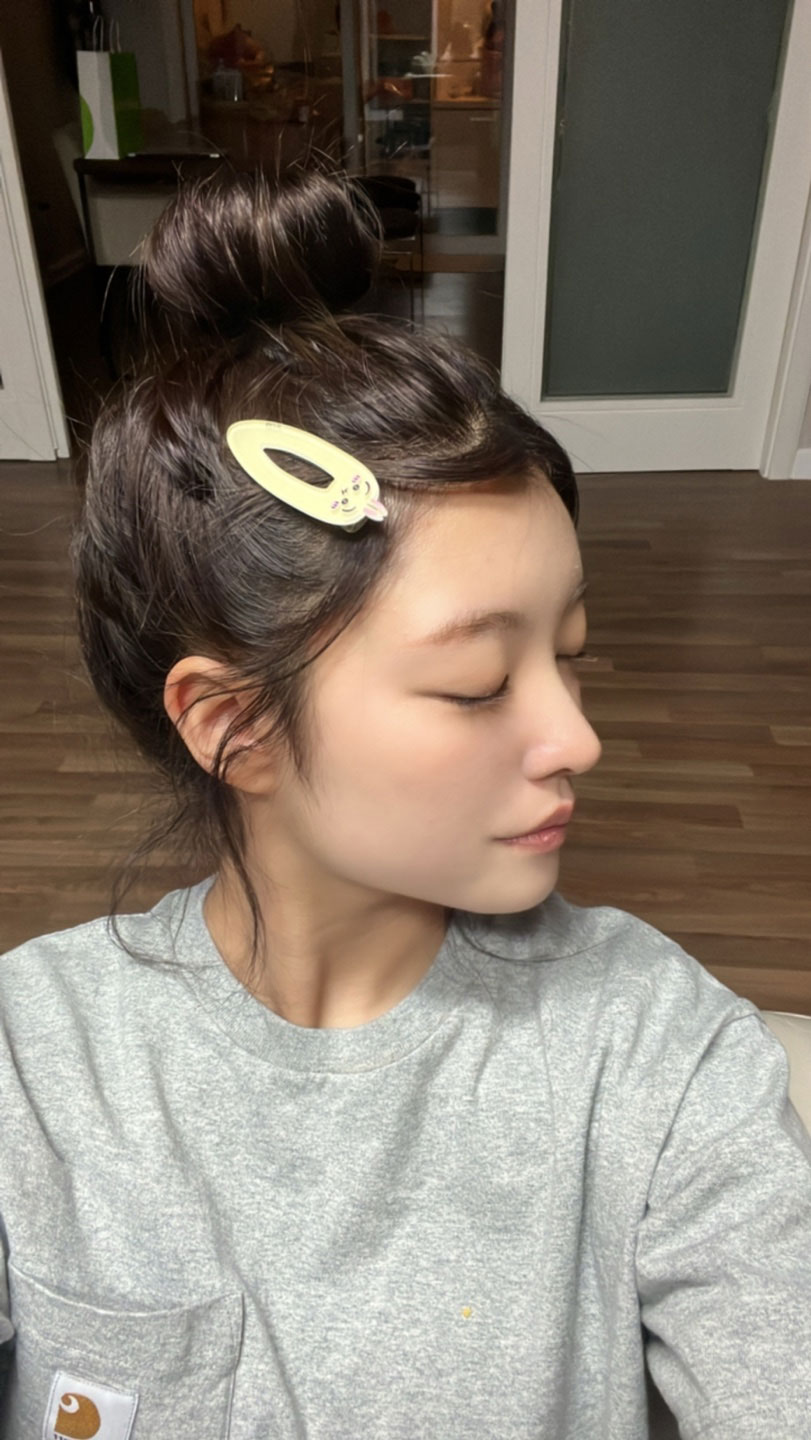 수술후기이미지