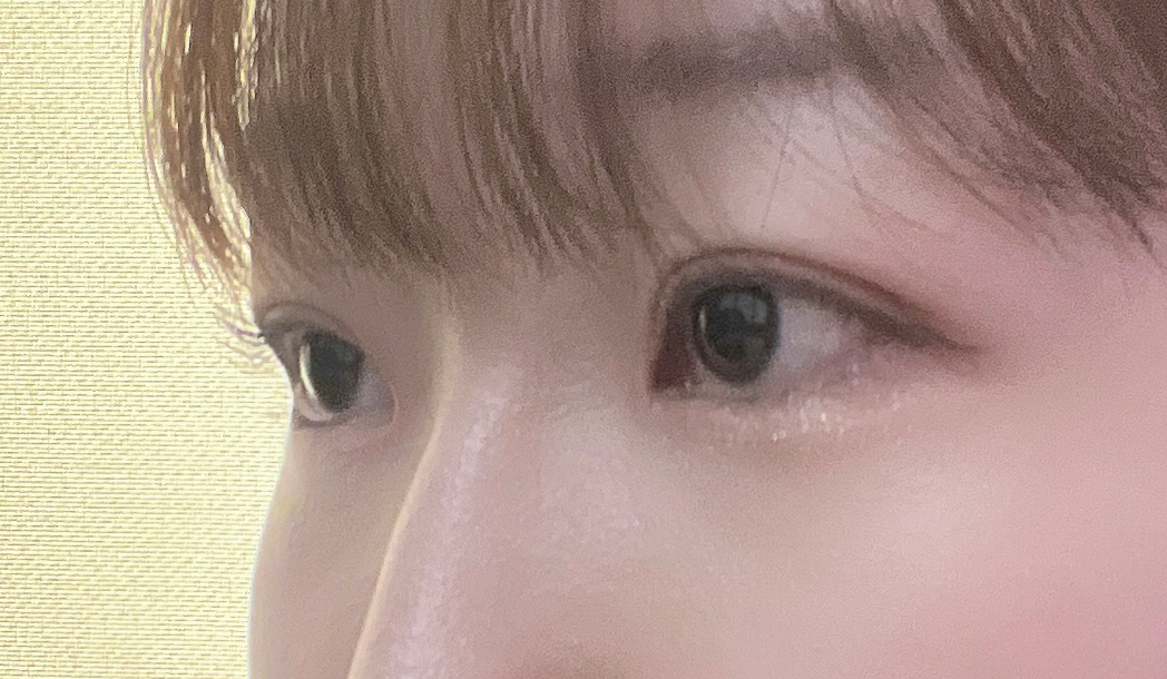 수술후기이미지