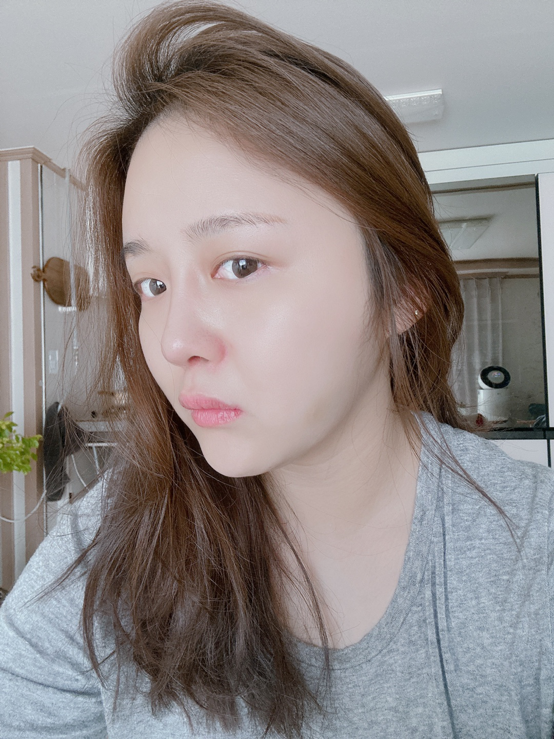 수술후기이미지