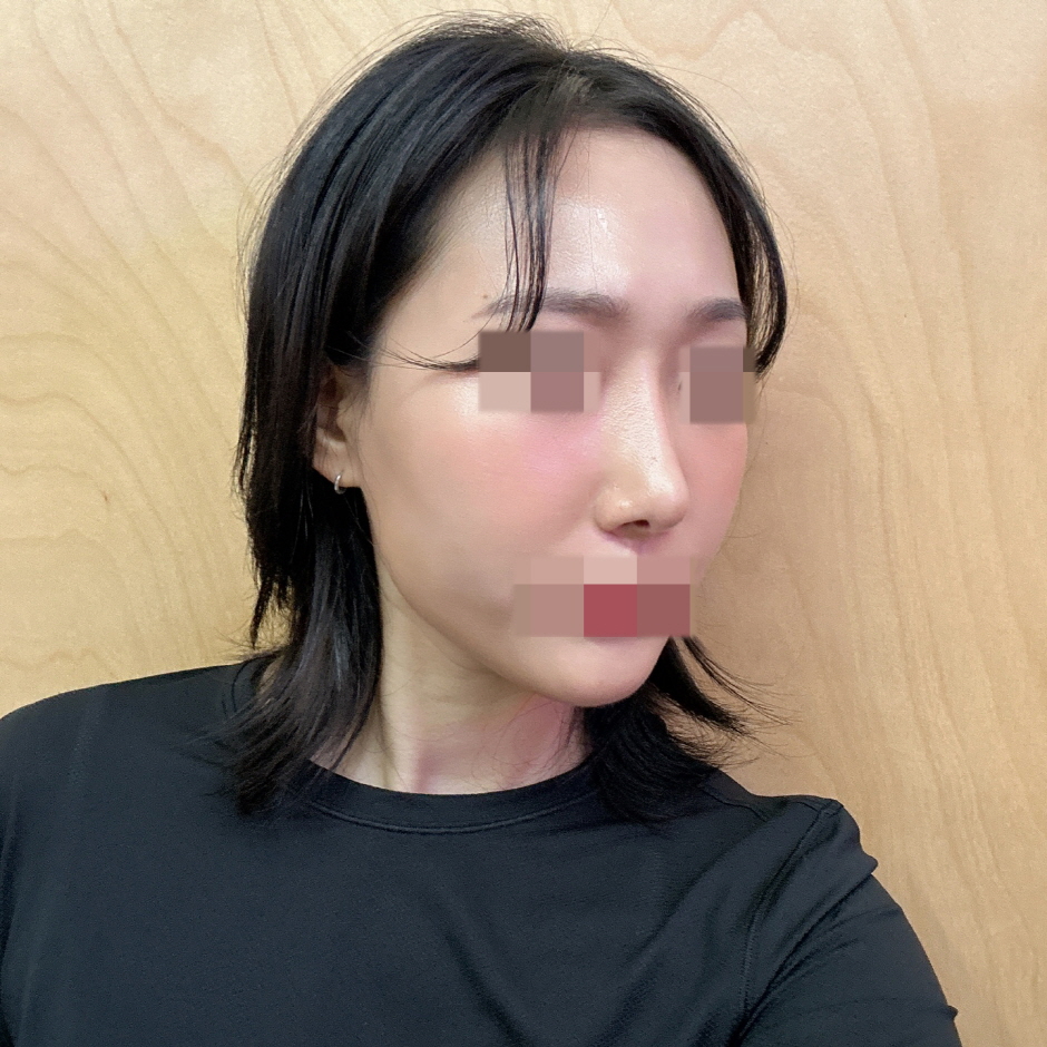 수술후기이미지