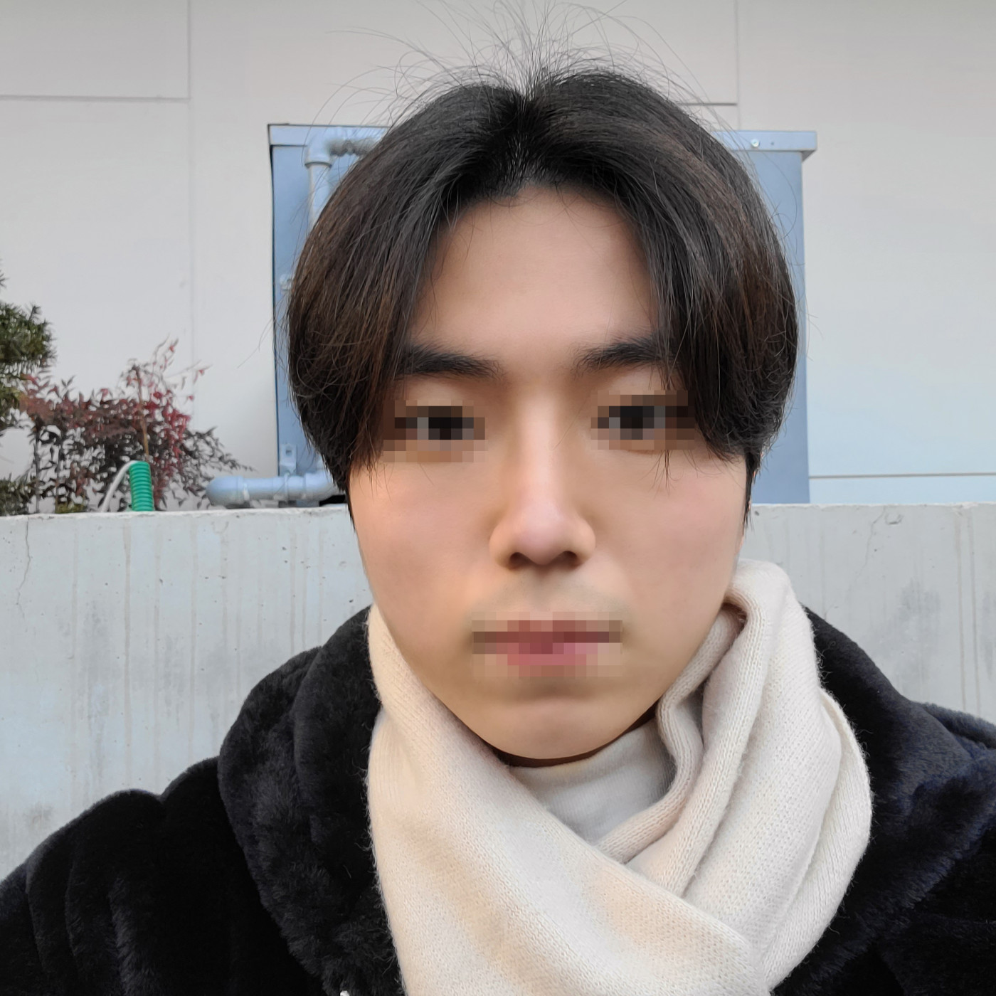 수술후기이미지