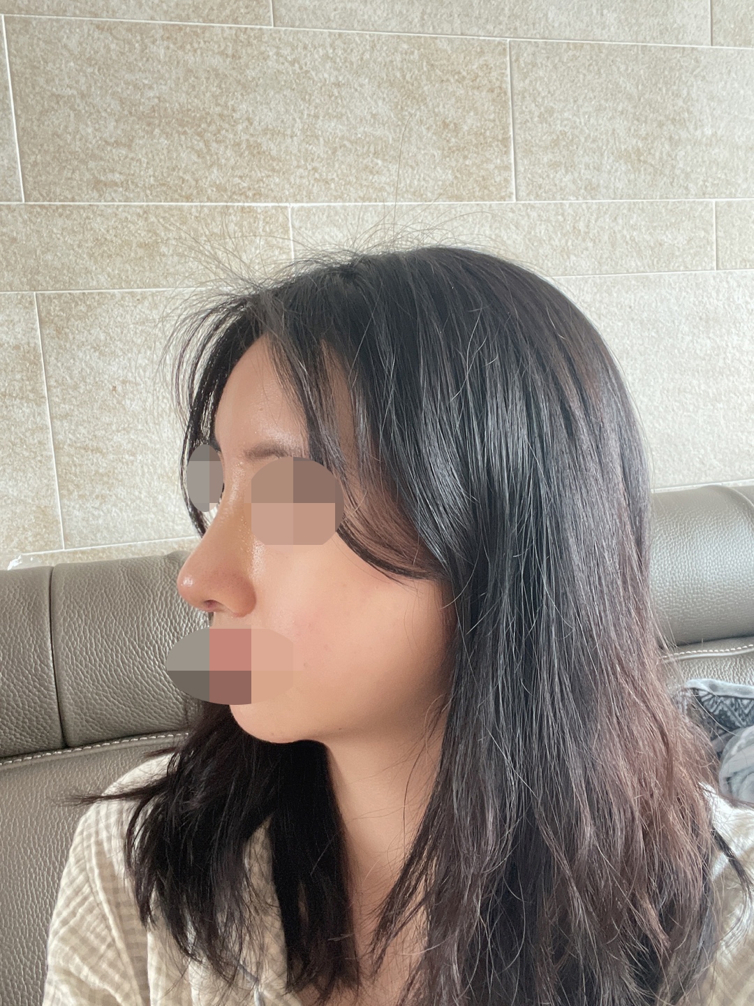 수술후기이미지