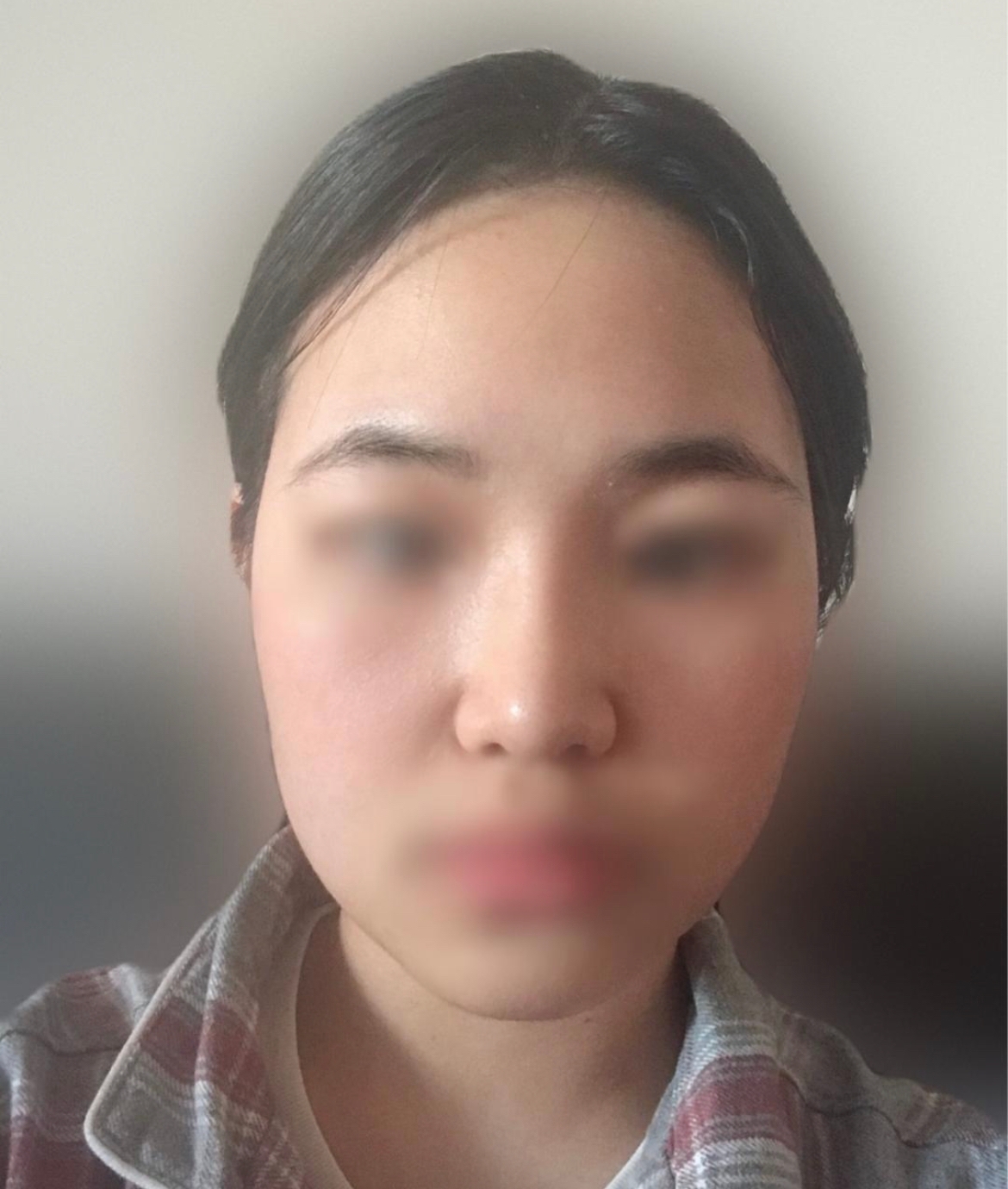 수술후기이미지