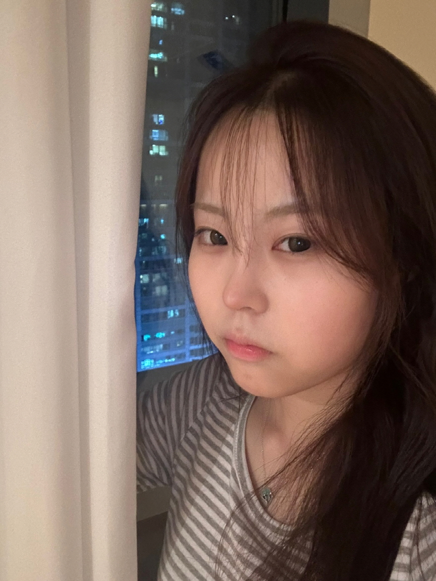 수술후기이미지