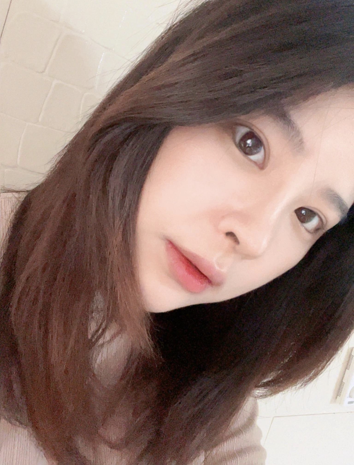 수술후기이미지