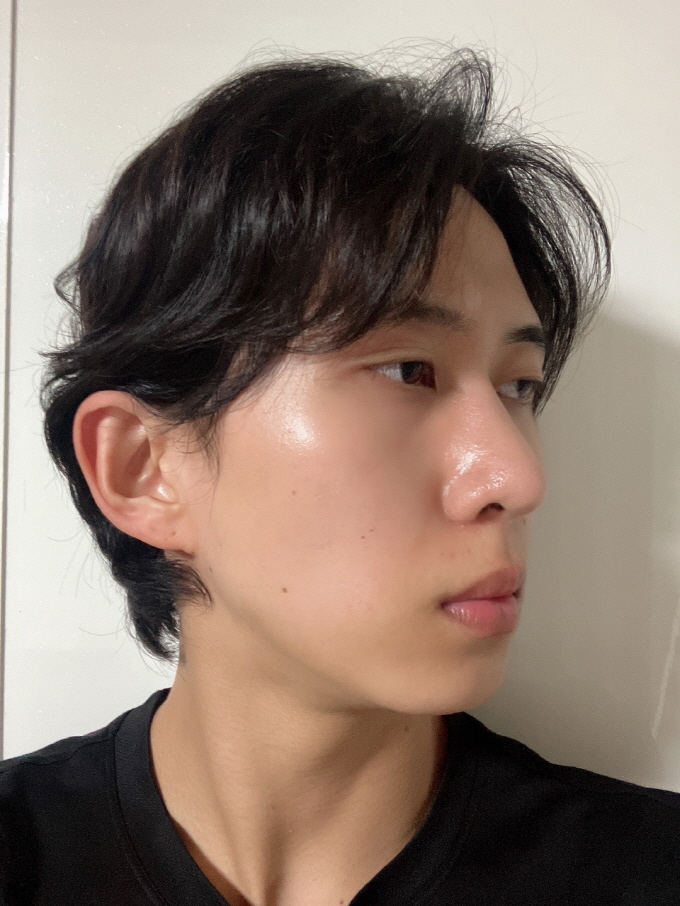 수술후기이미지