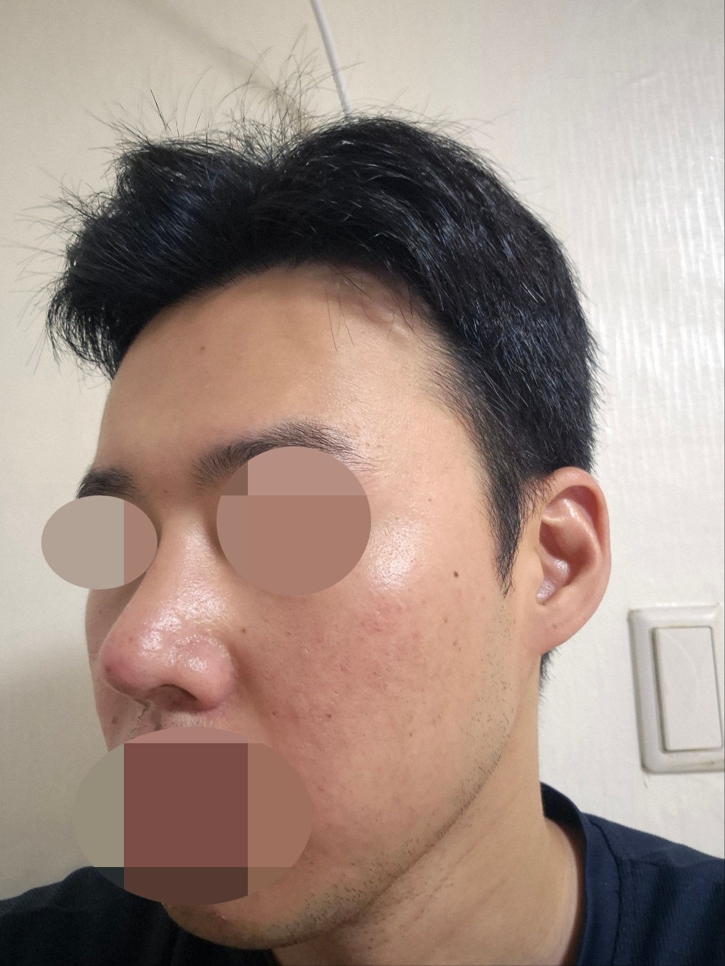 수술후기이미지