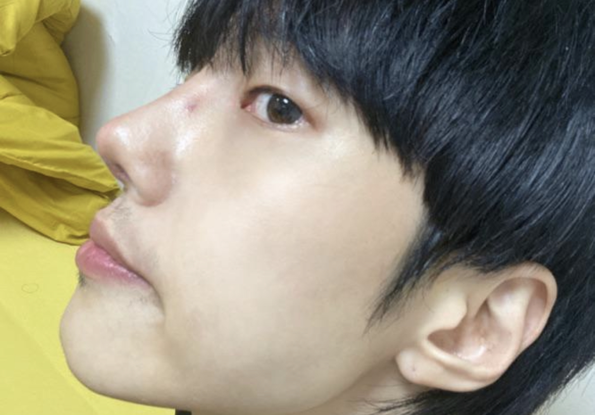 수술후기이미지