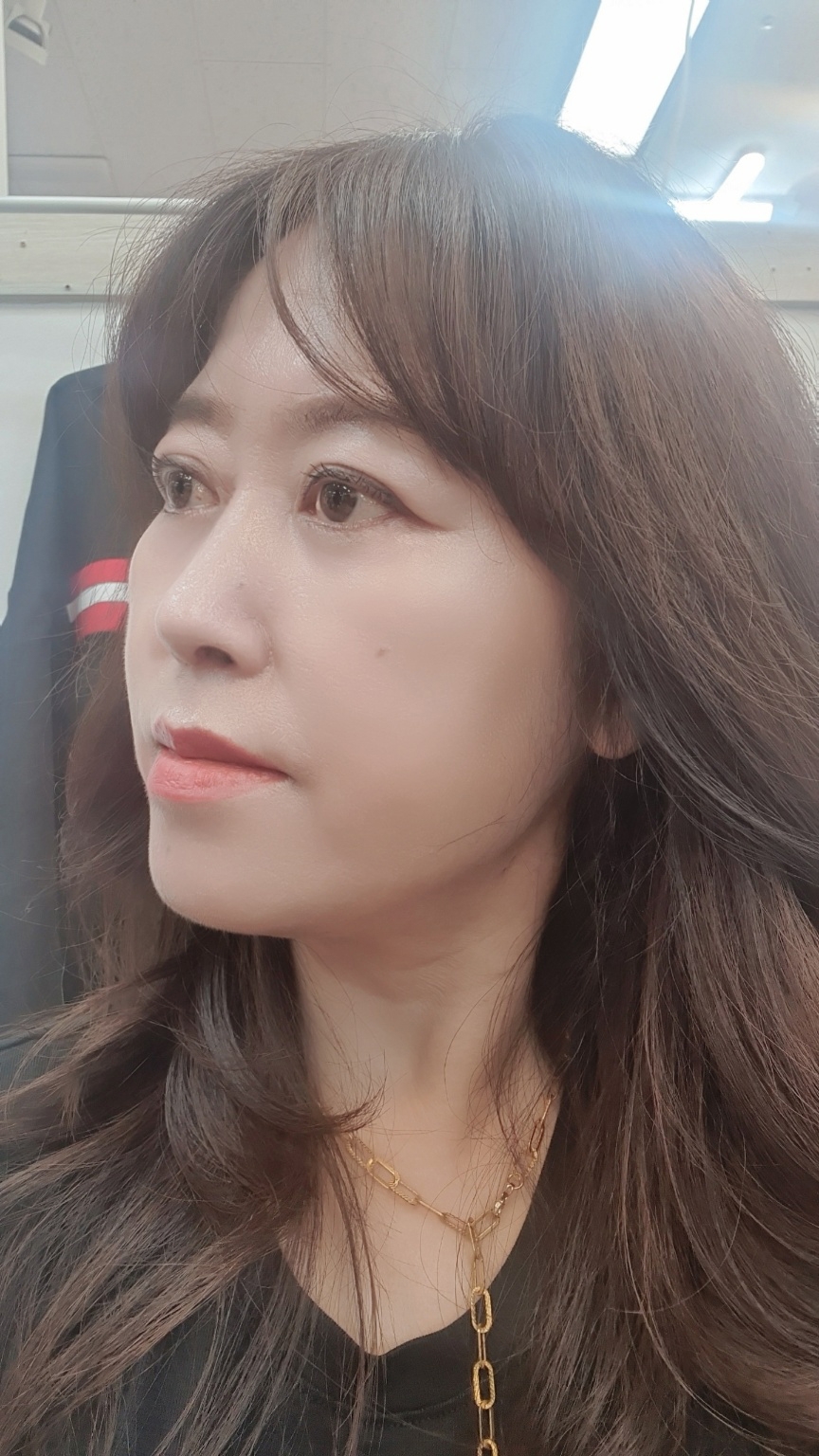 수술후기이미지