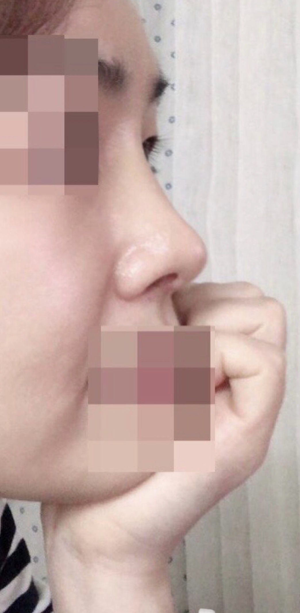 수술후기이미지