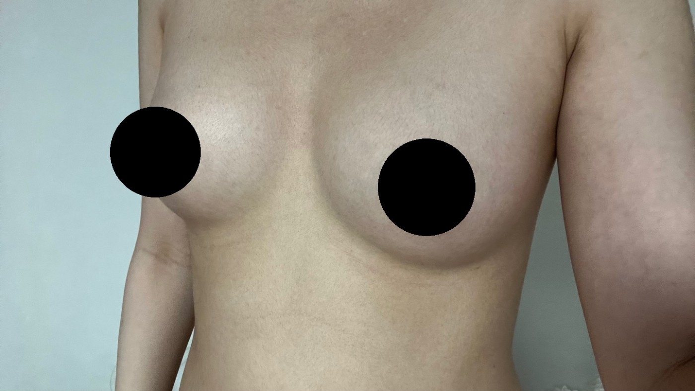 수술후기이미지