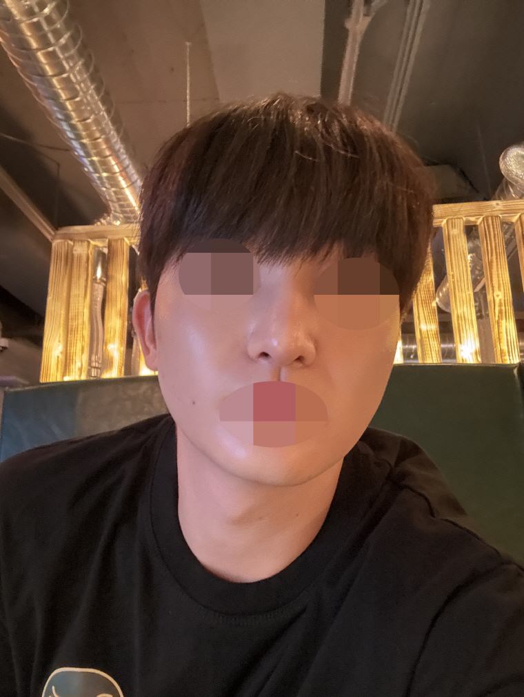 수술후기이미지