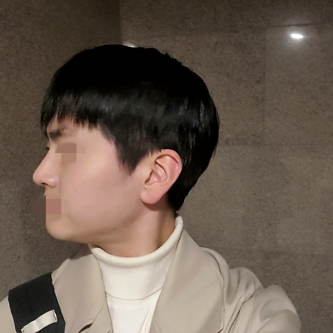 수술후기이미지