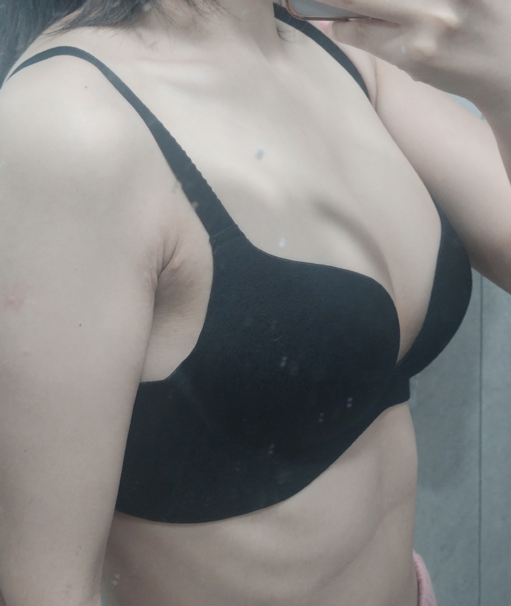 수술후기이미지