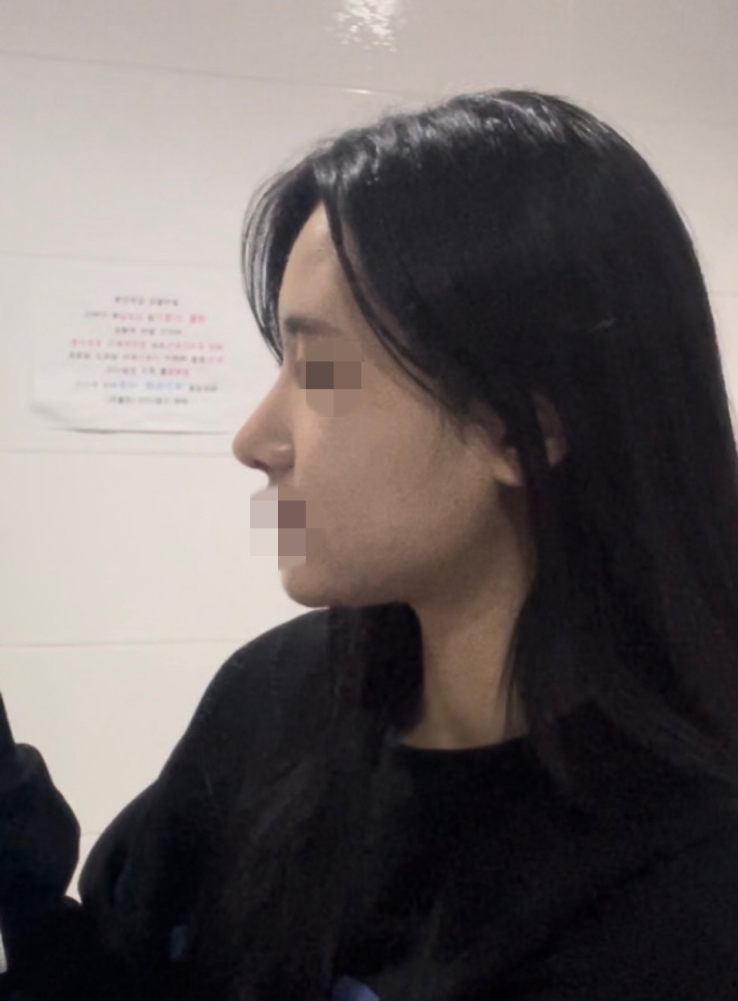 수술후기이미지