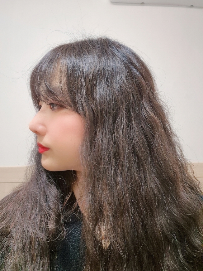 수술후기이미지