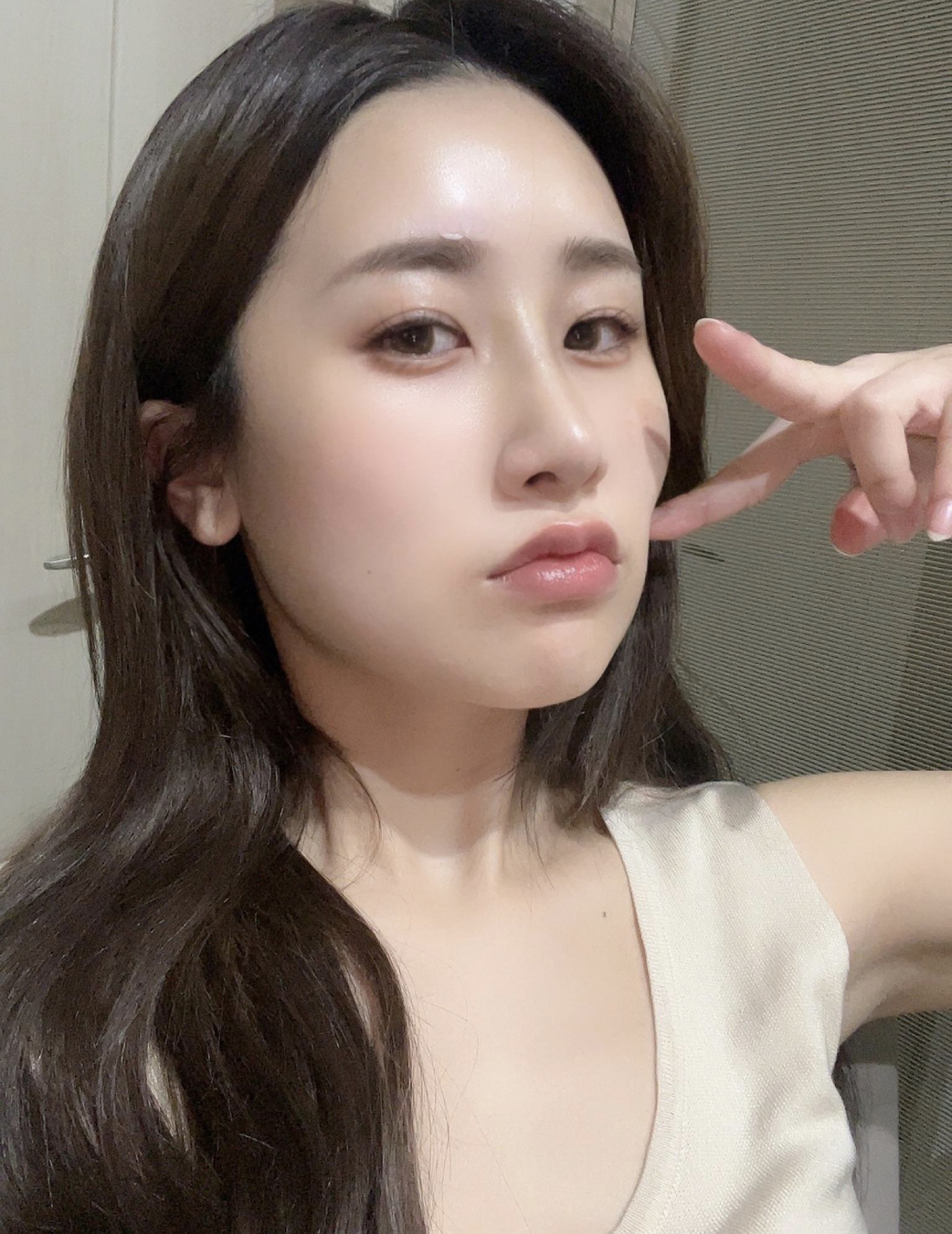 수술후기이미지