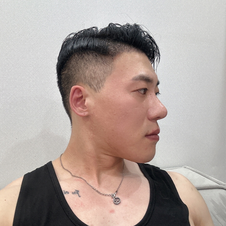 수술후기이미지