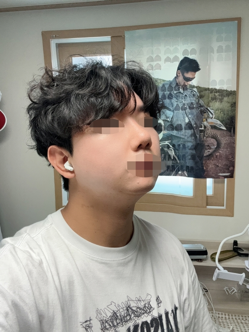 수술후기이미지