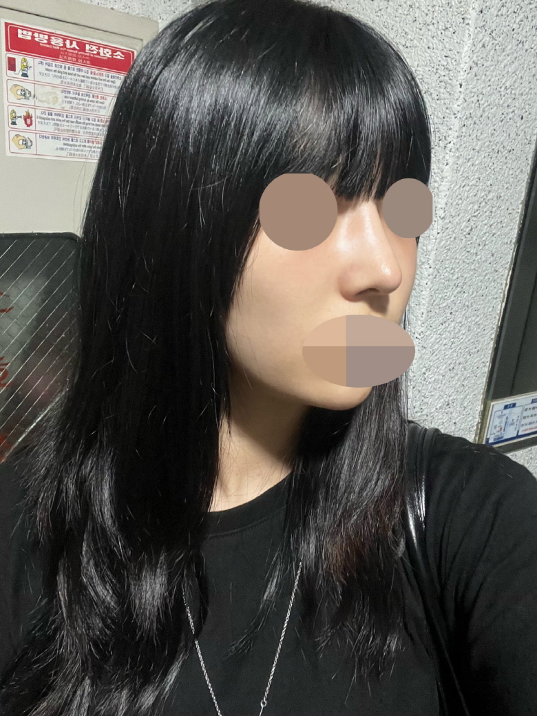 수술후기이미지