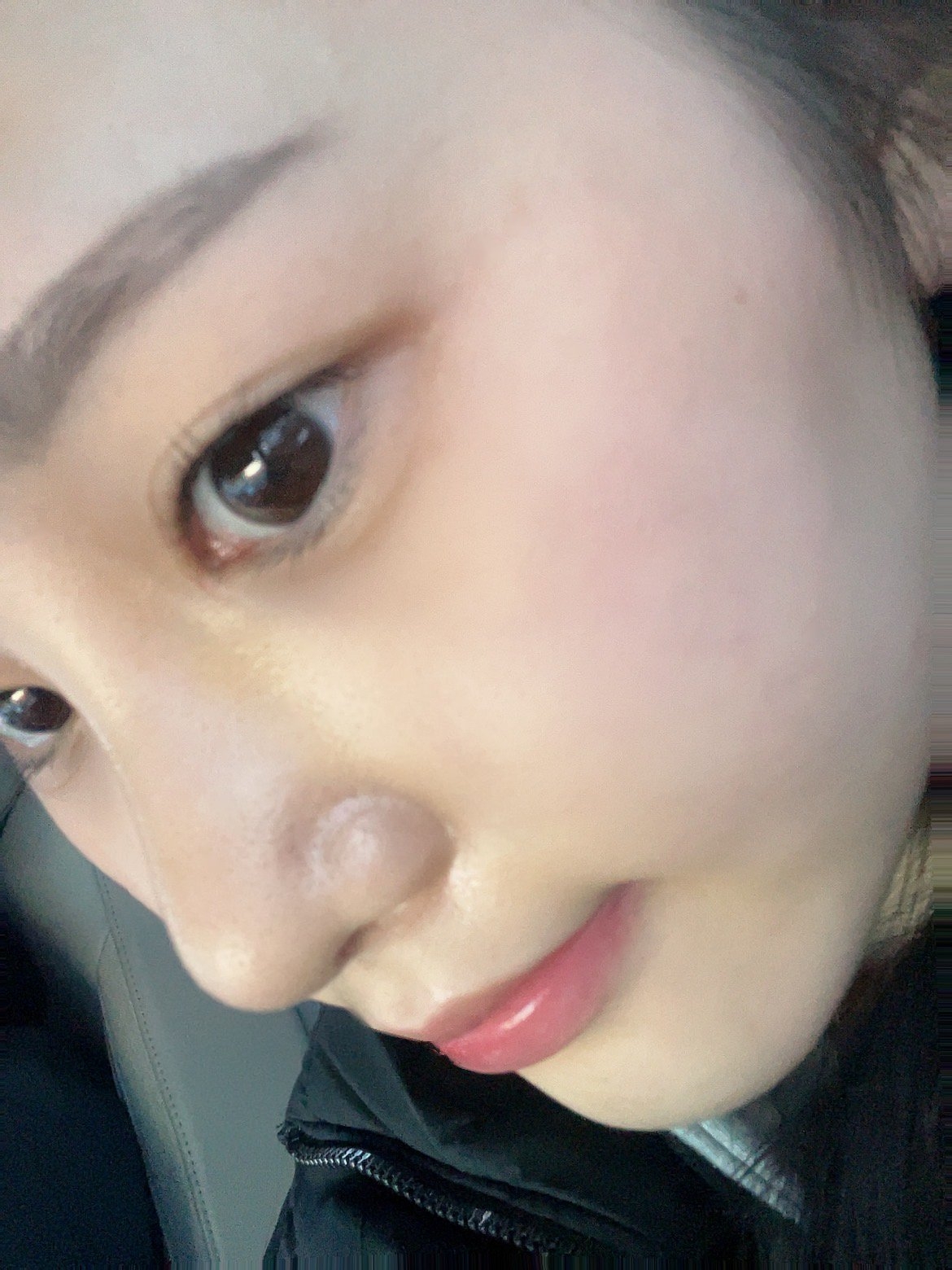 수술후기이미지