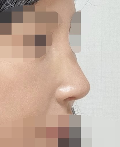 수술후기이미지