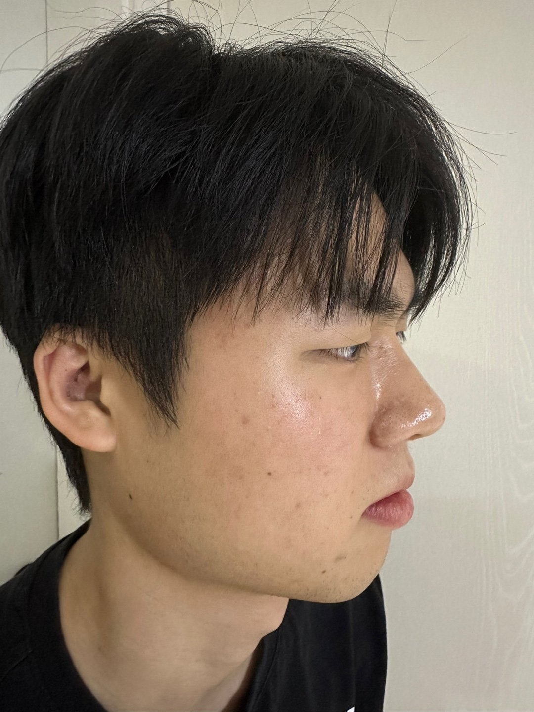 수술후기이미지