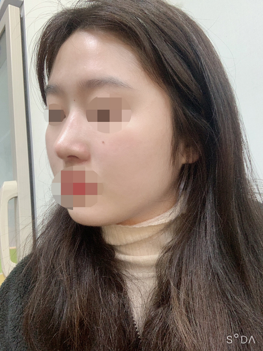 수술후기이미지