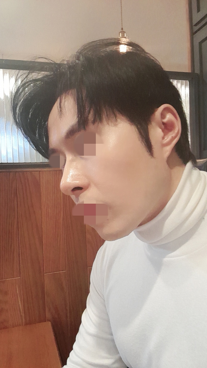 수술후기이미지