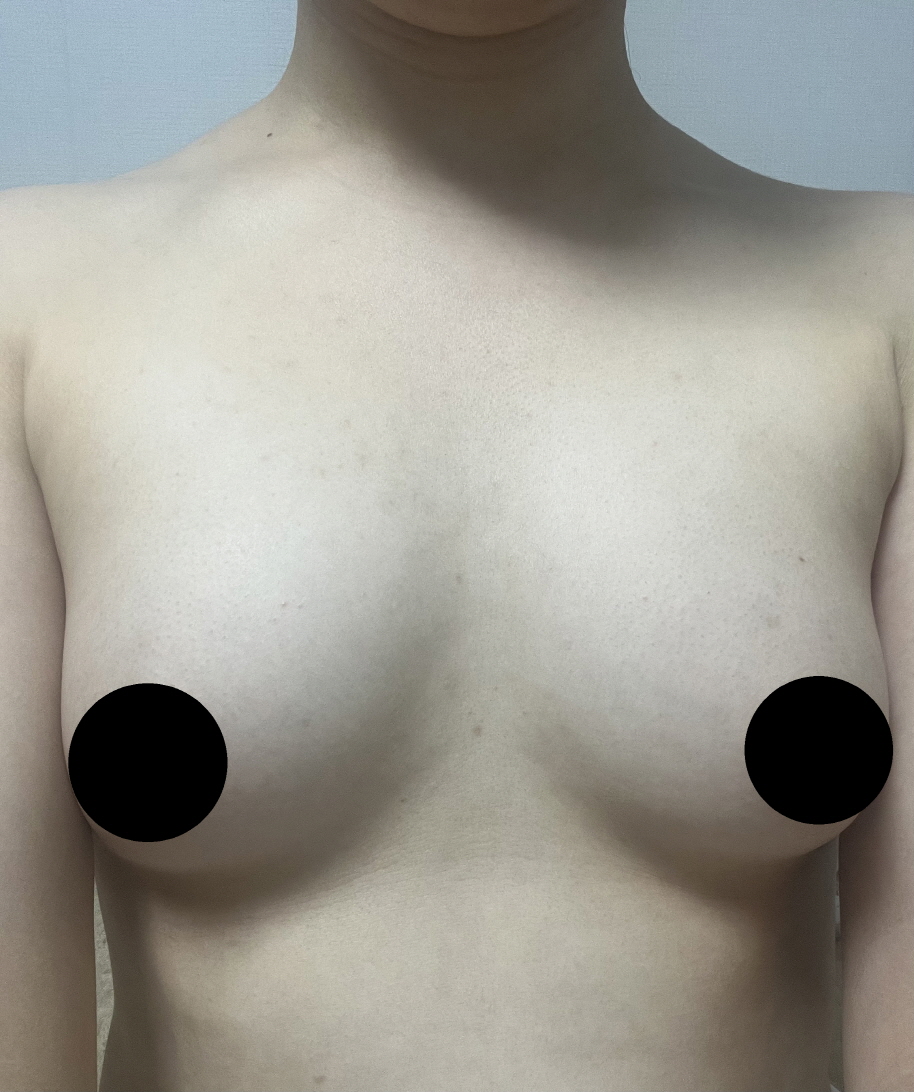 수술후기이미지