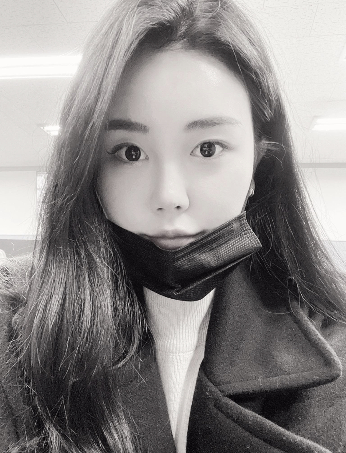 수술후기이미지