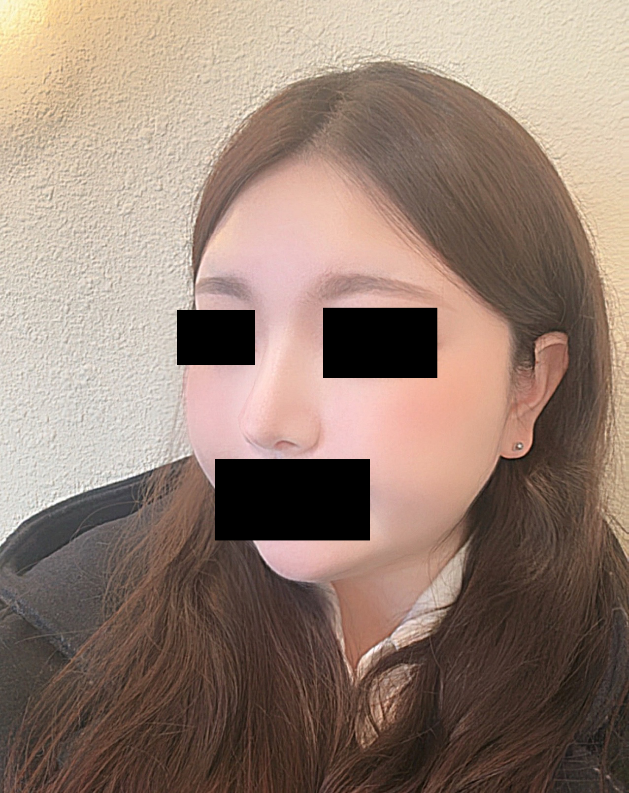 수술후기이미지