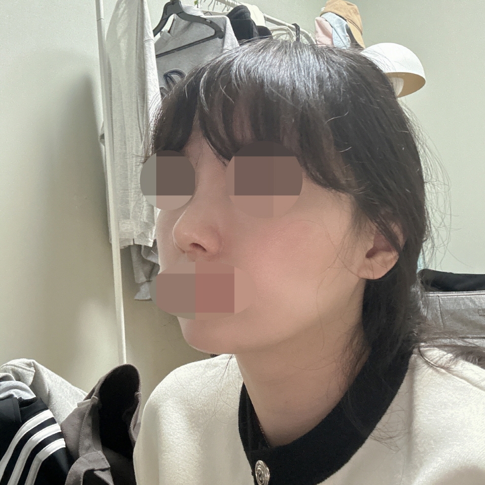 수술후기이미지