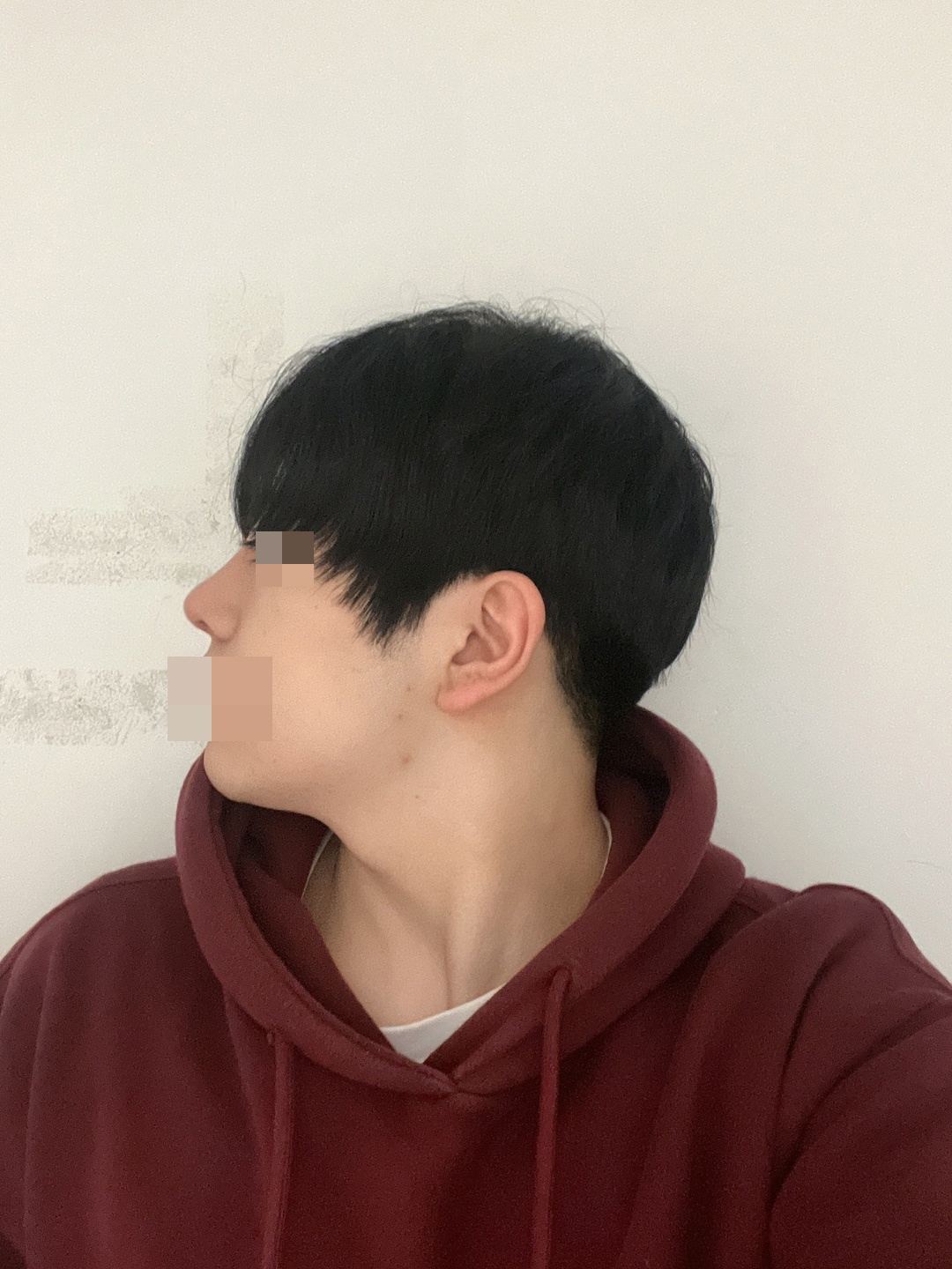 수술후기이미지