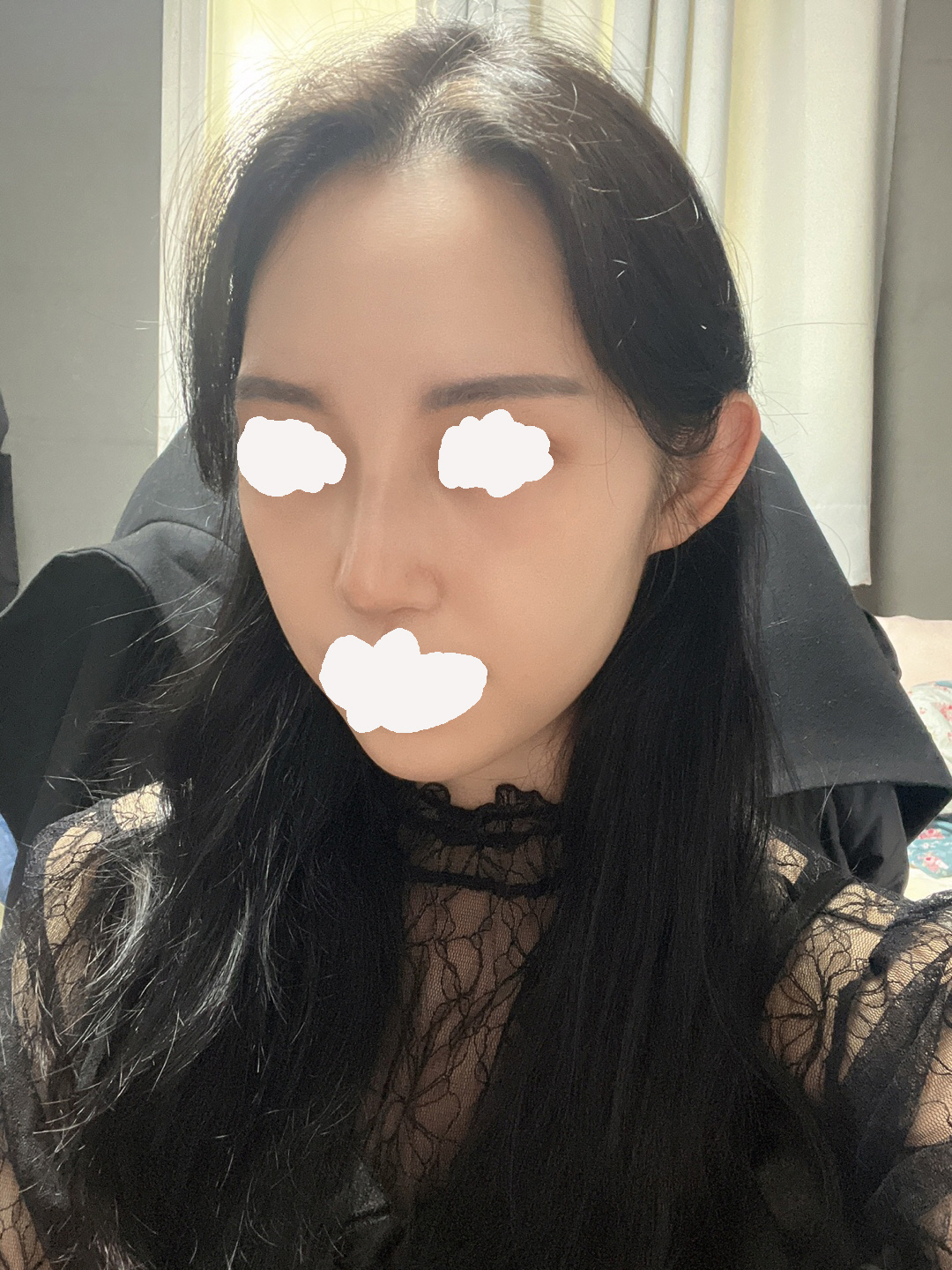 수술후기이미지