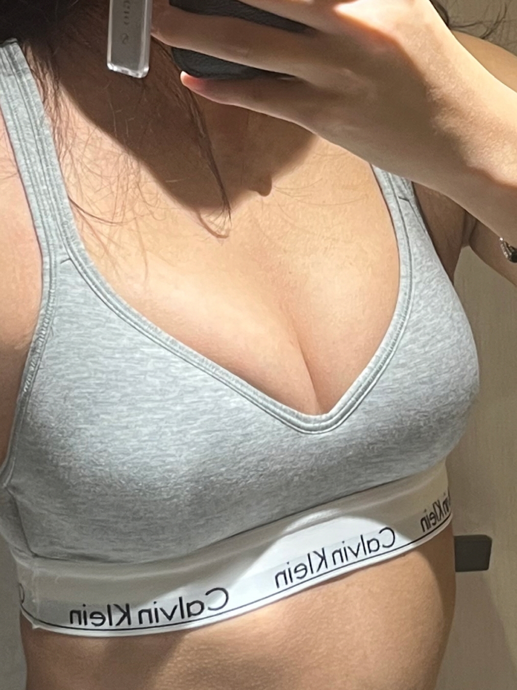 수술후기이미지