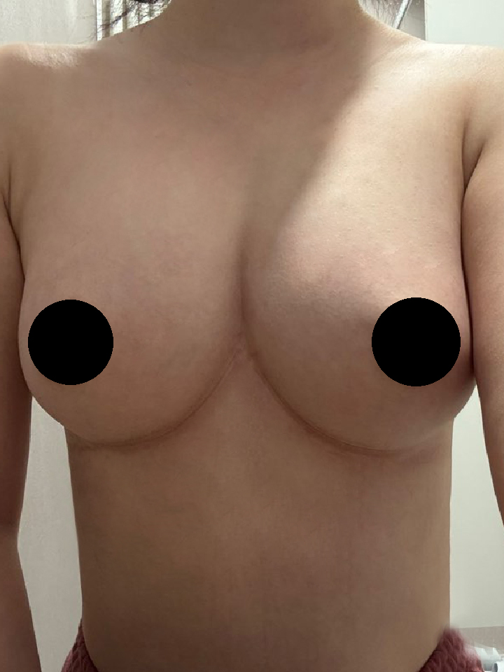 수술후기이미지