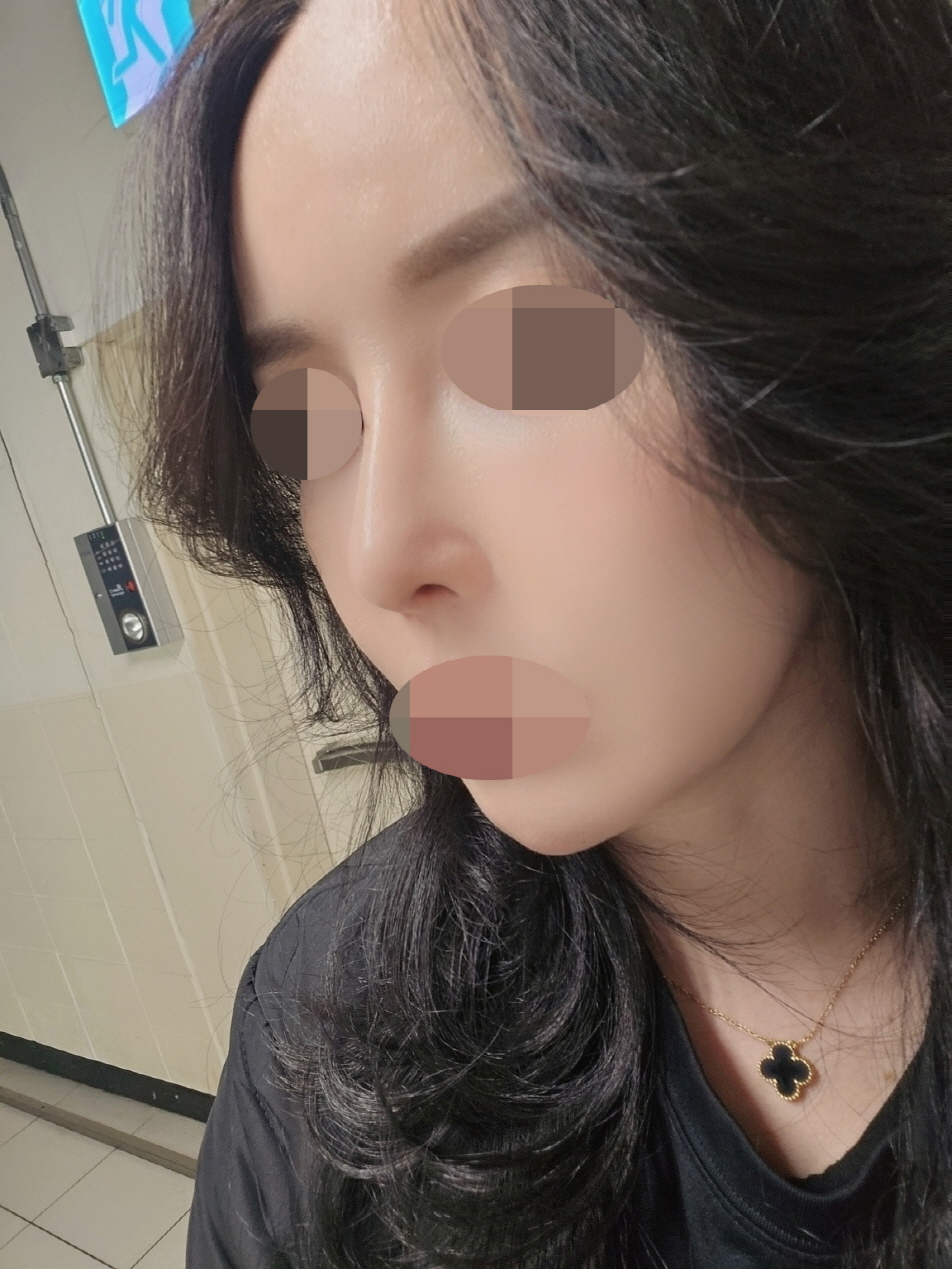 수술후기이미지