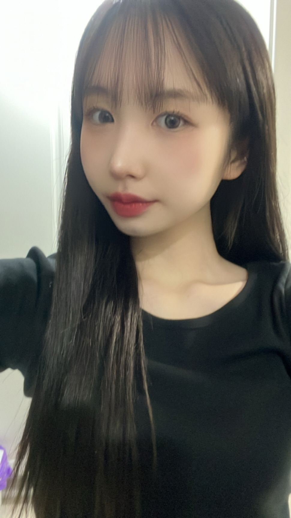 수술후기이미지